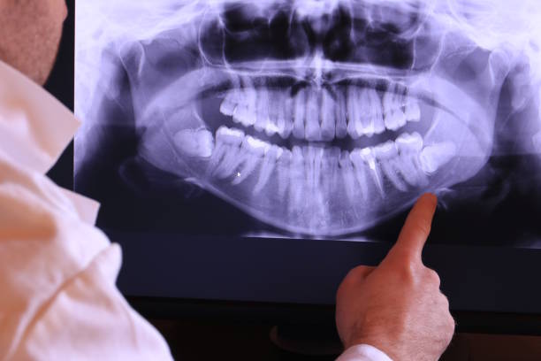 Best Dentist for Tooth Abscess  in Five Points, NC